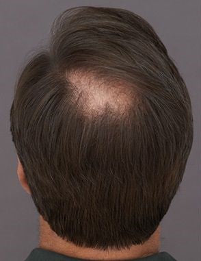 Before image